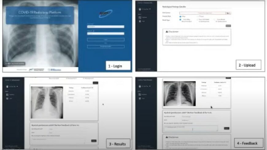 Prof. Bambang Riyanto Menjelaskan Perkembangan Penelitian Teknologi untuk Deteksi COVID-19 Berdasarkan CT-SCAN dan X-RAY